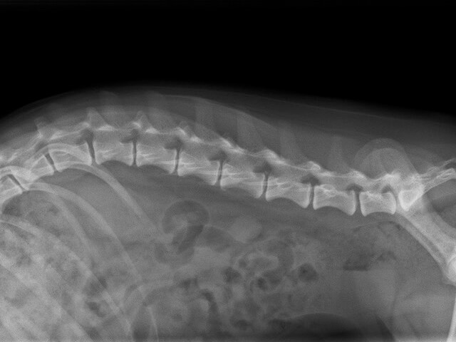 CT検査だからわかること