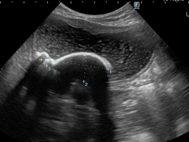 子宮蓄膿症の犬のケース